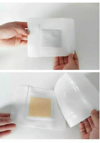 医疗器械怎么热敷贴并不是“暖宝宝”，正确使用看这里_https://www.jmylbn.com_新闻资讯_第5张